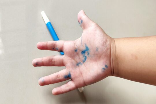 How to Remove Ink Stains from Hands or Skin Quickly